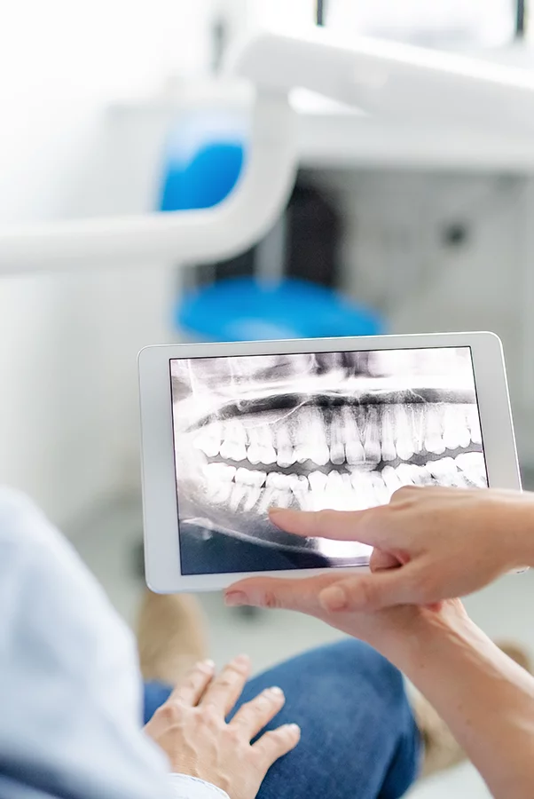 Imagen de una placa RX dental